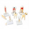 HUMAN TOOTH SET